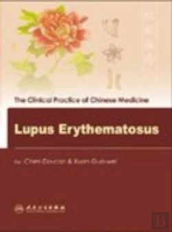Bertrand.pt - Lupus Erythematosus