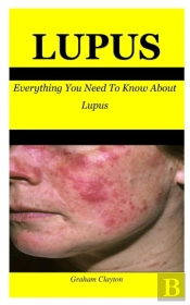 Lupus