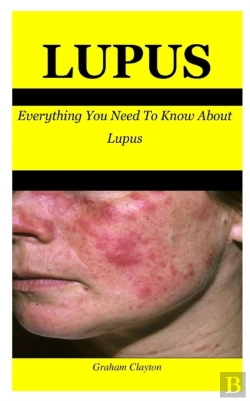 Bertrand.pt - Lupus