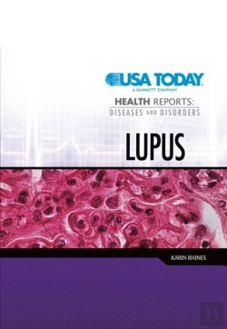 Bertrand.pt - Lupus