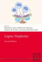 Lupus Nephritis
