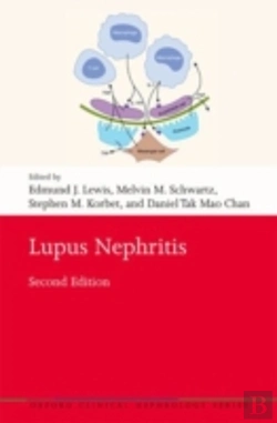 Bertrand.pt - Lupus Nephritis