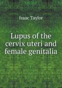 Lupus Of The Cervix Uteri And Female Genitalia