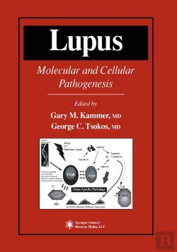 Bertrand.pt - Lupus