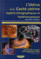 L'Utérus Et La Cavité Utérine ; Aspects Échographiques Et Hystéroscopiques