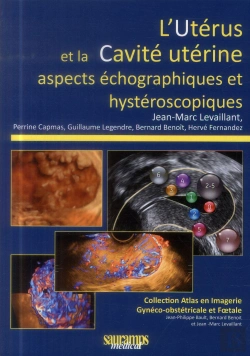 Bertrand.pt - L'Utérus Et La Cavité Utérine ; Aspects Échographiques Et Hystéroscopiques