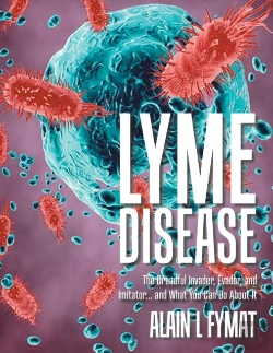 Bertrand.pt - Lyme Disease