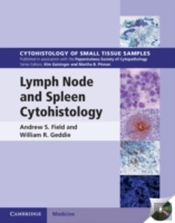 Bertrand.pt - Lymph Node And Spleen Cytohistology