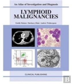Bertrand.pt - Lymphoid Malignancies