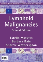 Lymphoid Malignancies