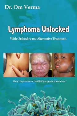 Bertrand.pt - Lymphoma Unlocked