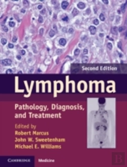 Bertrand.pt - Lymphoma