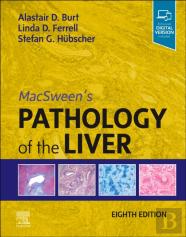 Macsween'S Pathology Of The Liver