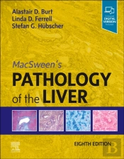 Macsween'S Pathology Of The Liver