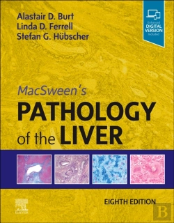 Bertrand.pt - Macsween'S Pathology Of The Liver