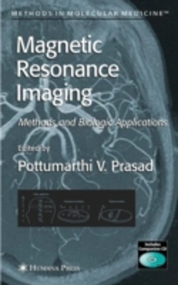 Bertrand.pt - Magnetic Resonance Imaging
