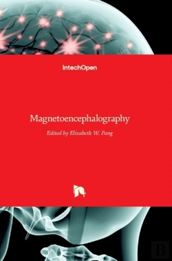 Bertrand.pt - Magnetoencephalography