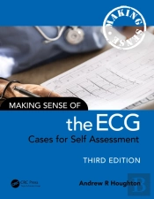 Making Sense Of The Ecg