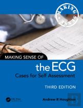 Making Sense Of The Ecg