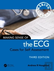 Making Sense Of The Ecg