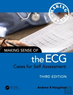 Bertrand.pt - Making Sense Of The Ecg