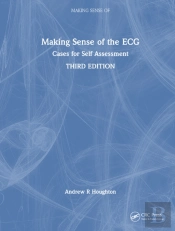 Making Sense Of The Ecg