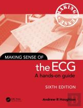 Making Sense Of The Ecg