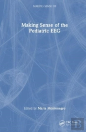Making Sense Of The Pediatric Eeg