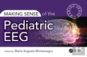 Making Sense Of The Pediatric Eeg