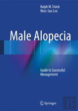 Male Alopecia