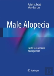 Male Alopecia