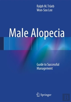 Bertrand.pt - Male Alopecia