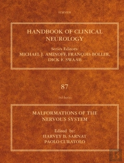 Bertrand.pt - Malformations Of The Nervous System