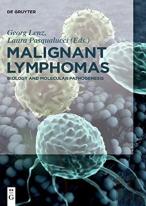 Malignant Lymphomas