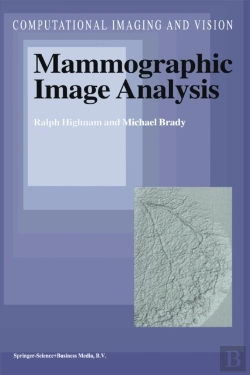 Bertrand.pt - Mammographic Image Analysis