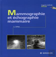 Mammographie Et Échographie Mammaire