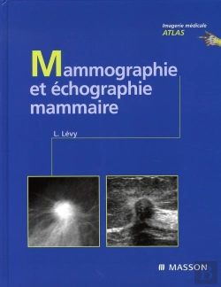 Bertrand.pt - Mammographie Et Échographie Mammaire