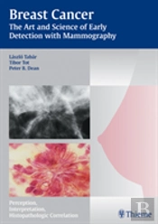 Mammography - The Art And Science Of Early Detection