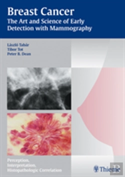 Bertrand.pt - Mammography - The Art And Science Of Early Detection