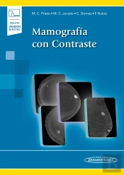 Mamografia Con Contraste