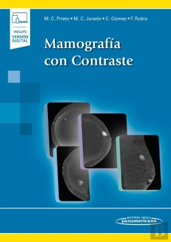 Bertrand.pt - Mamografia Con Contraste