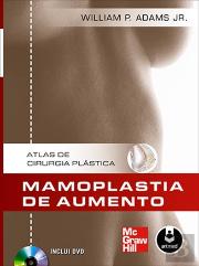 Mamoplastia de Aumento
