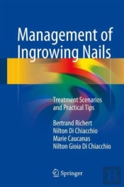 Management Of Ingrowing Nails