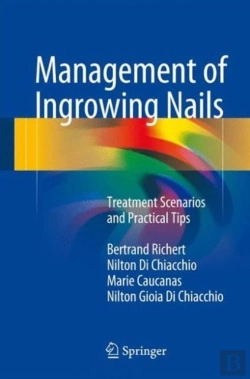 Bertrand.pt - Management Of Ingrowing Nails