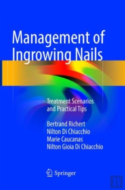 Bertrand.pt - Management Of Ingrowing Nails