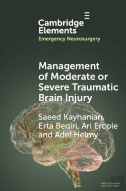 Bertrand.pt - Management Of Moderate Or Severe Traumatic Brain Injury