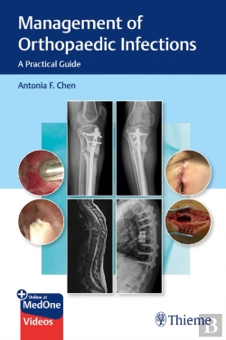 Bertrand.pt - Management Of Orthopaedic Infections