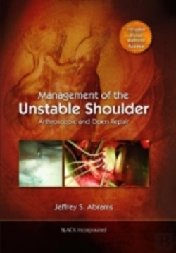 Bertrand.pt - Management Of The Unstable Shoulder