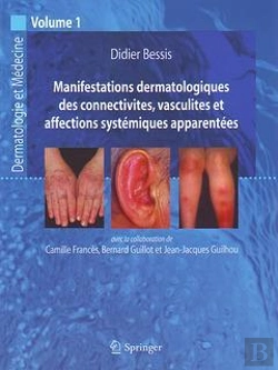 Bertrand.pt - Manifestations Dermatologiques De Collectivites, Vasculites Et Affections Systémiques Apparentées