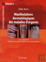 Manifestations Dermatologiques Des Maladies D'Organe